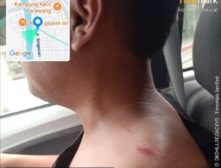 Jurnalis Dianiaya Saat Liputan Obat Terlarang di Karawang, Diduga Libatkan Oknum TNI